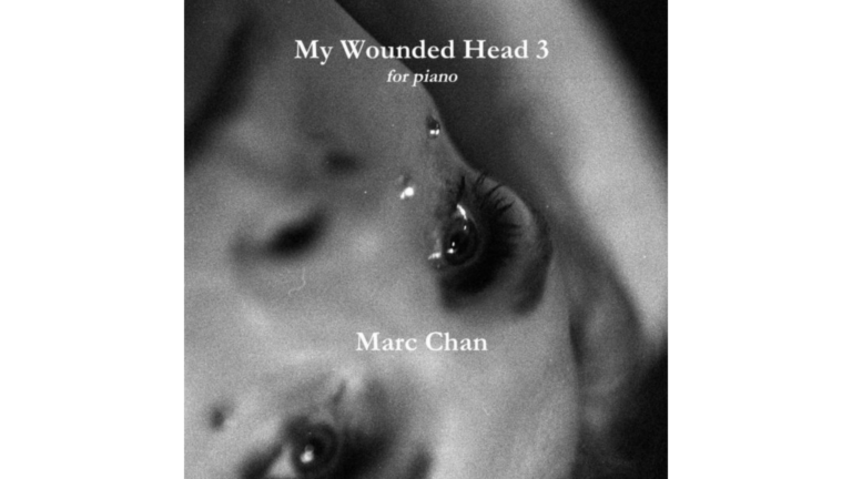 MyWoundedHead3